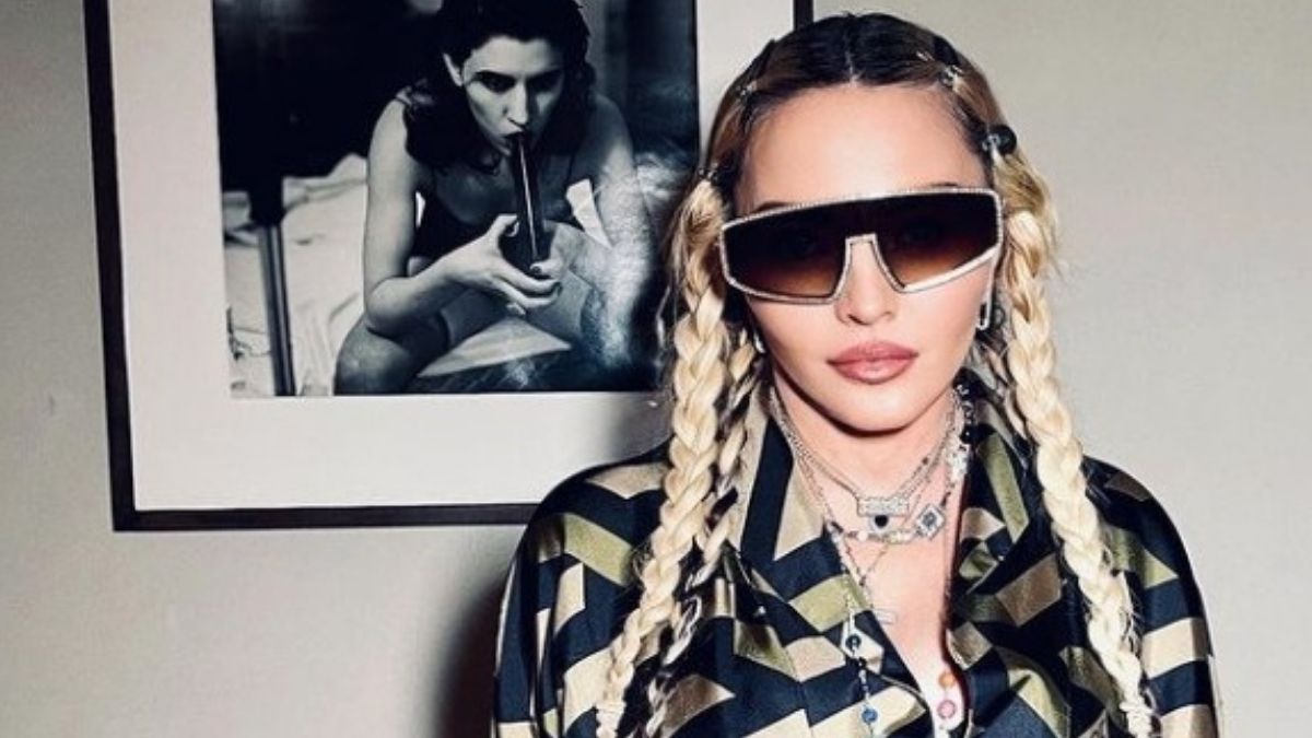 Madonna Proudly Shows The Bruises On Her Entire Thigh While Rocking Versace In New Instagram Post